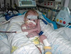 An infant lies in a hospital bed surrounded by medical equipment and monitors.